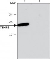 Anti-TIMP2 antibody, Mouse monoclonal 