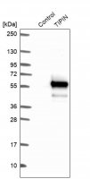 Anti-TIPIN antibody produced in rabbit