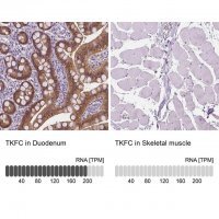 Anti-TKFC antibody produced in rabbit 