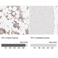 Anti-TKT antibody produced in rabbit 