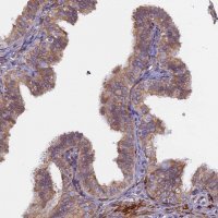 Anti-TLCD1 antibody produced in rabbit 