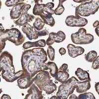 Anti-TLDC1 antibody produced in rabbit 