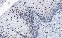 Anti-TLE3 Antibody, clone 1D15 ZooMAb� Rabbit Monoclonal 