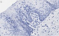 Anti-TLE3 Antibody, clone 1D15 ZooMAb� Rabbit Monoclonal 