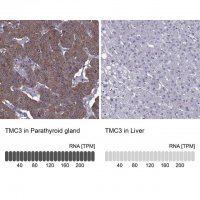 Anti-TMC3 antibody produced in rabbit