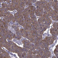 Anti-TMC3 antibody produced in rabbit
