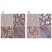 Anti-TMC5 antibody produced in rabbit 