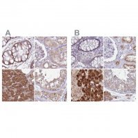 Anti-TMED10 antibody produced in rabbit 