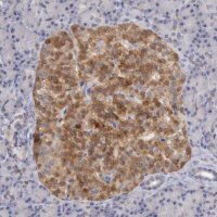 Anti-TMED8 antibody produced in rabbit