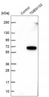 Anti-TMEM102 antibody produced in rabbit 