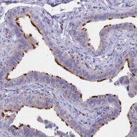 Anti-TMEM138 antibody produced in rabbit