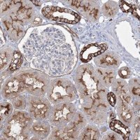 Anti-TMEM139 antibody produced in rabbit 