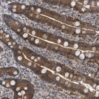 Anti-TMEM159 antibody produced in rabbit 