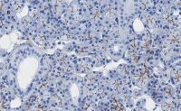 Anti-TMEM16A Antibody, clone 3J18, ZooMAb® Rabbit Monoclonal