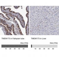 Anti-TMEM173 antibody produced in rabbit