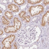 Anti-TMEM174 antibody produced in rabbit 