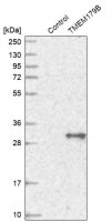 Anti-TMEM179B antibody produced in rabbit HPA016585-100UL