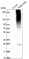 Anti-TMEM184B antibody produced in rabbit HPA024076-100UL