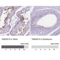 Anti-TMEM210 antibody produced in rabbit