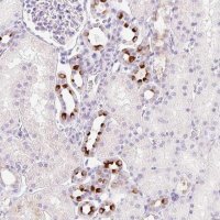 Anti-TMEM213 antibody produced in rabbit 