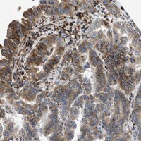 Anti-TMEM248 antibody produced in rabbit HPA016495-100UL