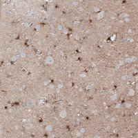 Anti-TMEM255A antibody produced in rabbit HPA048470-100UL
