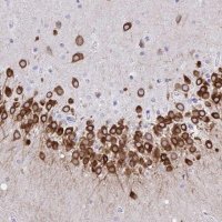 Anti-TMEM35A antibody produced in rabbit