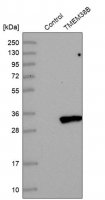 Anti-TMEM38B antibody produced in rabbit HPA018465-100UL