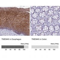 Anti-TMEM40 antibody produced in rabbit 