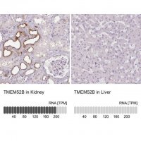 Anti-TMEM52B antibody produced in rabbit 