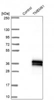 Anti-TMEM61 antibody produced in rabbit 