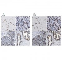 Anti-TMEM87A antibody produced in rabbit 