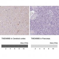 Anti-TMEM88B antibody produced in rabbit 