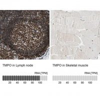 Anti-TMPO antibody produced in rabbit 