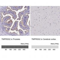 Anti-TMPRSS2 antibody produced in rabbit