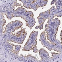 Anti-TMPRSS2 antibody produced in rabbit