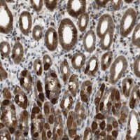 Anti-TMX3 antibody produced in rabbit HPA014157-100UL