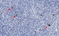 Anti-TNF/LTA Antibody, clone 3B20-H2 ZooMAb� Rabbit Monoclonal 