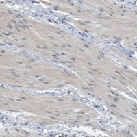 Anti-TNFAIP1 antibody produced in rabbit HPA014641-100UL