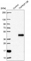 Anti-TNFRSF13B antibody produced in rabbit 