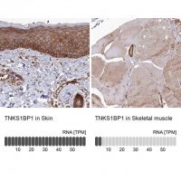 Anti-TNKS1BP1 antibody produced in rabbit 