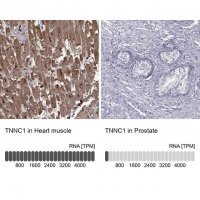 Anti-TNNC1 antibody produced in rabbit 