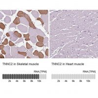 Anti-TNNC2 antibody produced in rabbit 