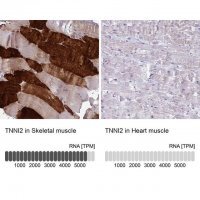 Anti-TNNI2 antibody produced in rabbit 