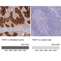 Anti-TNNT1 antibody produced in rabbit