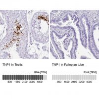 Anti-TNP1 antibody produced in rabbit 