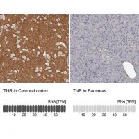 Anti-TNR antibody produced in rabbit 