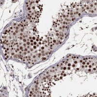 Anti-TOE1 antibody produced in rabbit HPA069119-100UL