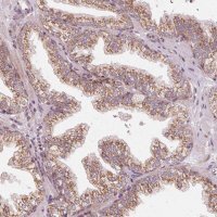 Anti-TOMM70 antibody produced in rabbit 