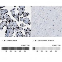 Anti-TOP1 antibody produced in rabbit 